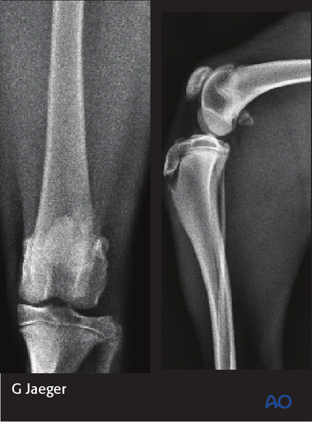 Radiographs of the stifle joint