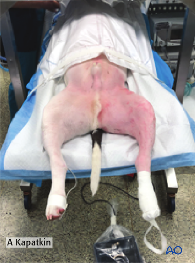 Patient positioning in dorsal recumbency