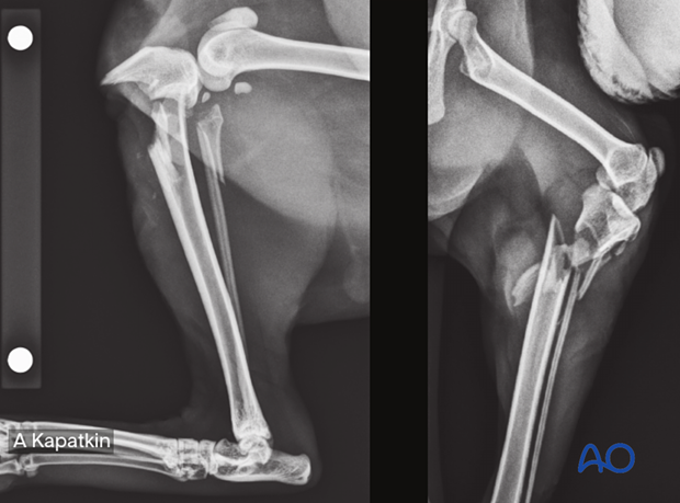 9-year-old Domestic Shorthair cat with a grade 1 open A3 tibiofibular fracture of the left pelvic limb