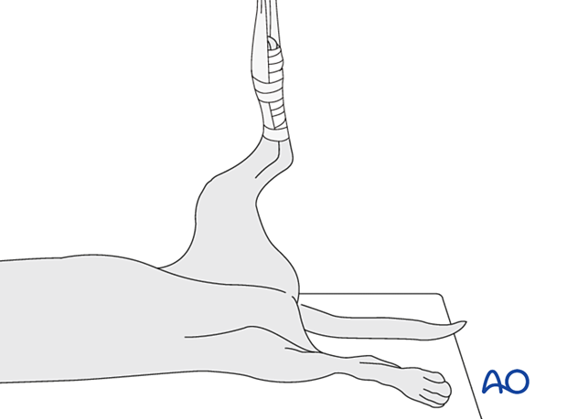 The patient is placed in dorsal recumbency