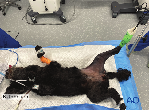 Dorsal recumbency