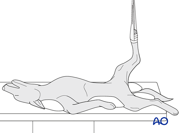 Angled Recumbency Pins and tension band with lag screw fixation for Simple articular ...