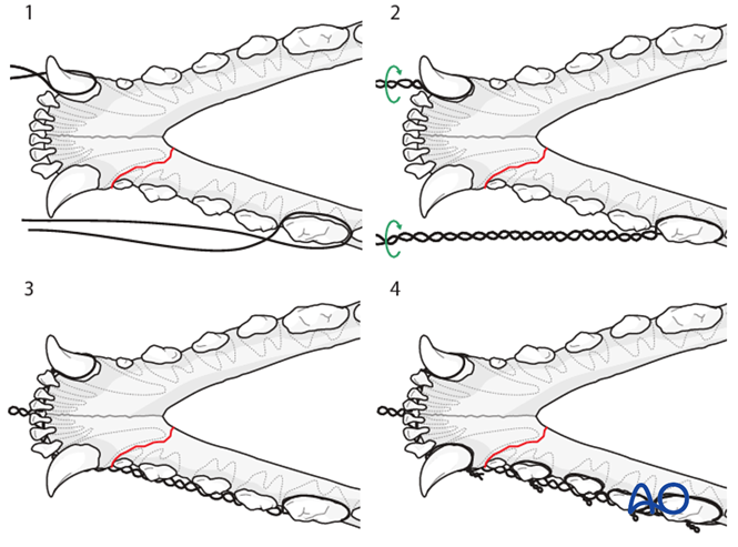 Wire reinforced intraoral splinting for Mandible, Rostral: Unilateral ...
