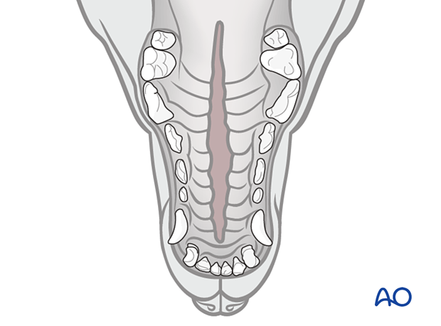 P600 Combined treatment