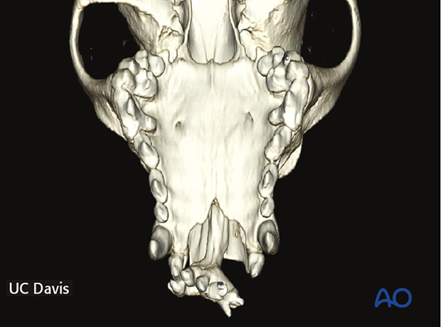 Preoperative 3D CT image showing the exact size and shape of the defect