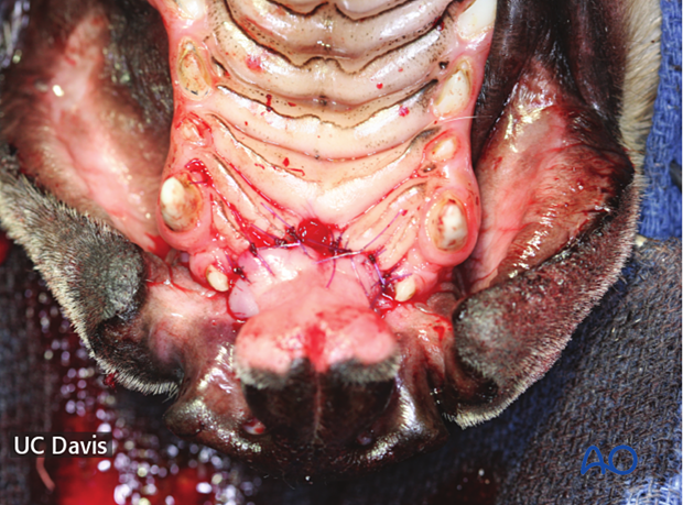 Complete repair of the oral site of the dentoalveolar cleft