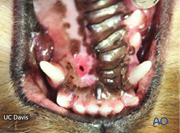 Small flap dehiscence should be repaired