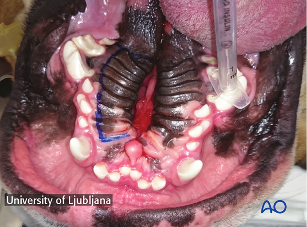 Planning of the hinged flap