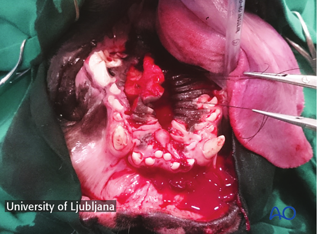 manipulation of the flap using stay sutures