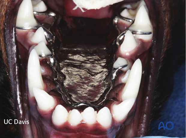 Palatal obturator application