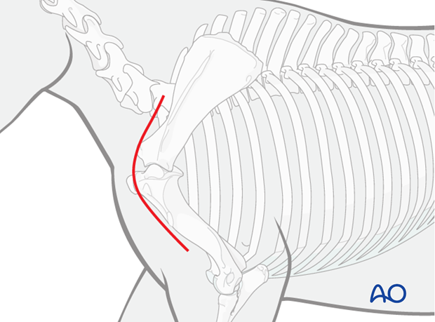shoulder arthrodesis