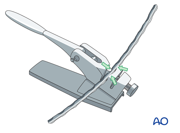 shoulder arthrodesis