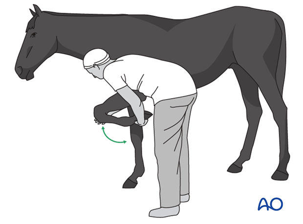 plate fixation