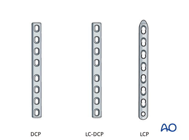 double plate fixation