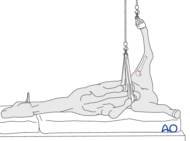 Angled Recumbency Lateral recumbency