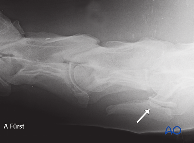 h50_D00_p06 definition