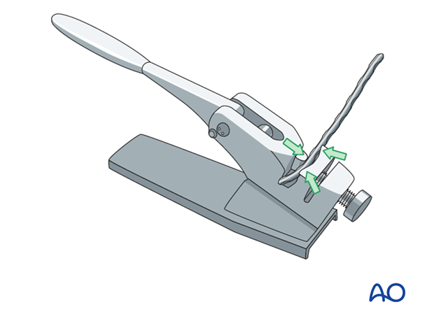plate fixation ventrally