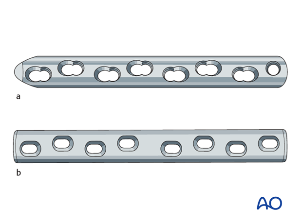plate fixation
