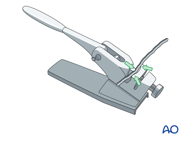 arthrodesis with plates