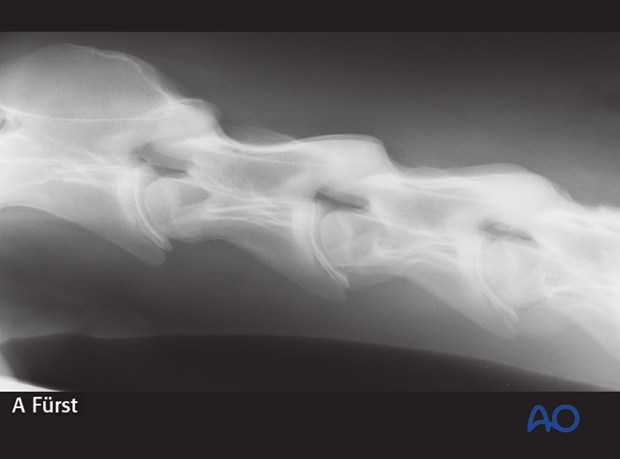 arthrodesis with plates