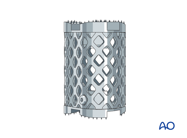 arthrodesis with kerf cut cylinder