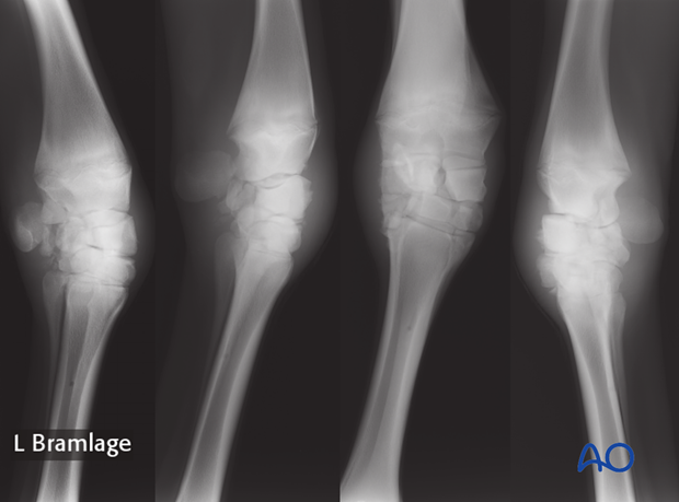 H70_Diag_D100_p010 definition