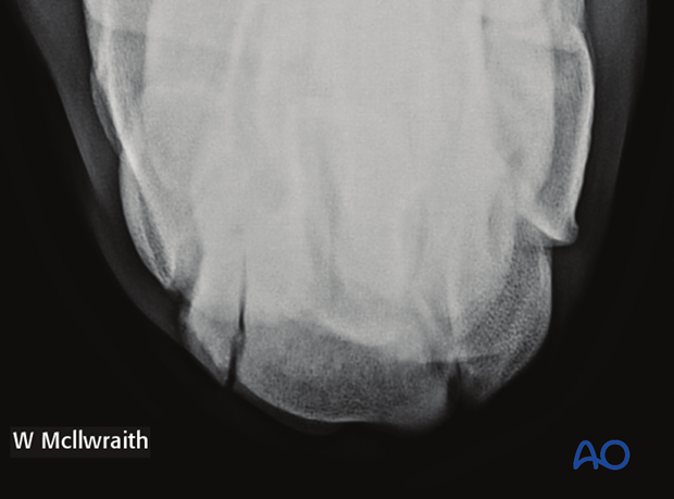 H70_Diag_D450_p010 definition