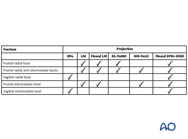 Table 1: Recognition of Carpal Bone Fractures on the different Radiographic Projections