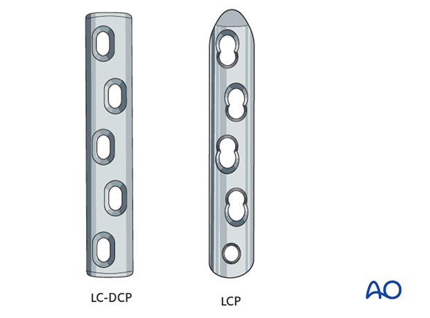 partial carpal arthrodesis