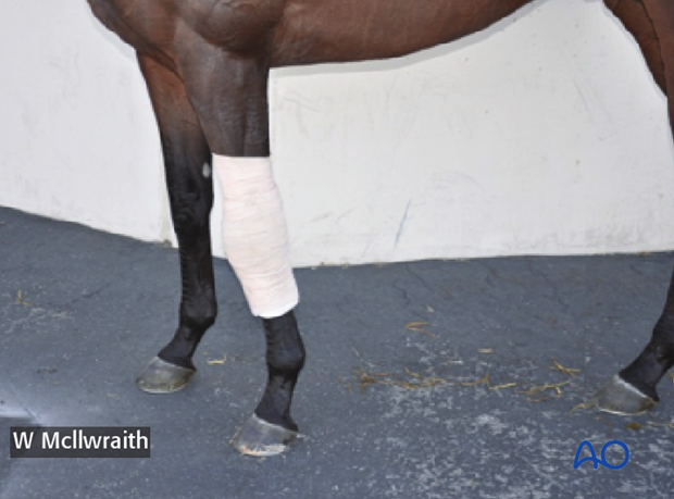 arthroscopic screw fixation