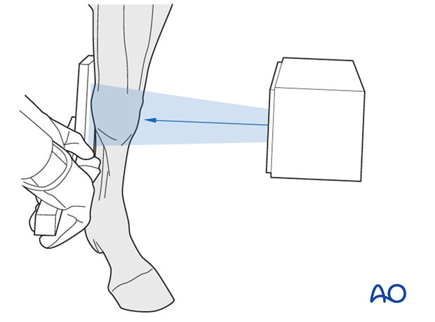 H70_xRay_i140 definition