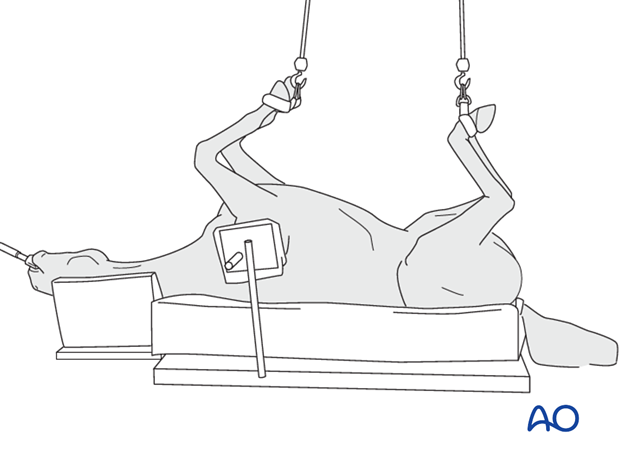 Dorsal recumbency