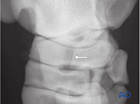 Simple fractures of the central tarsal bone - nonsurgical treatment