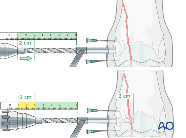 H87_C10_i350 Measure drill depth