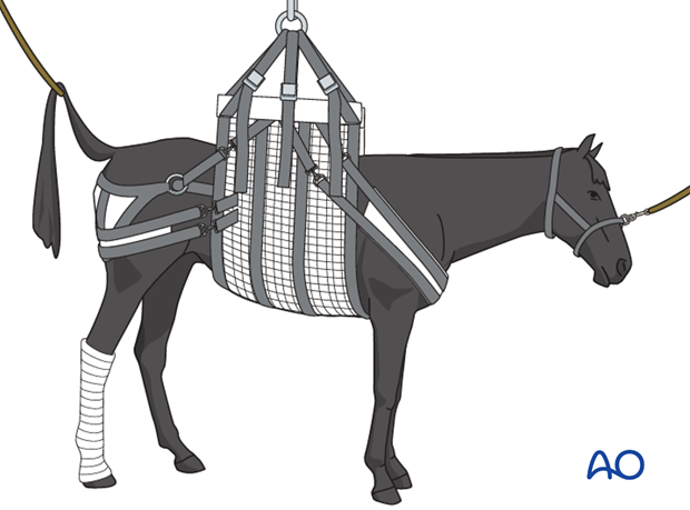 Medial incomplete condylar fracture - screw fixation