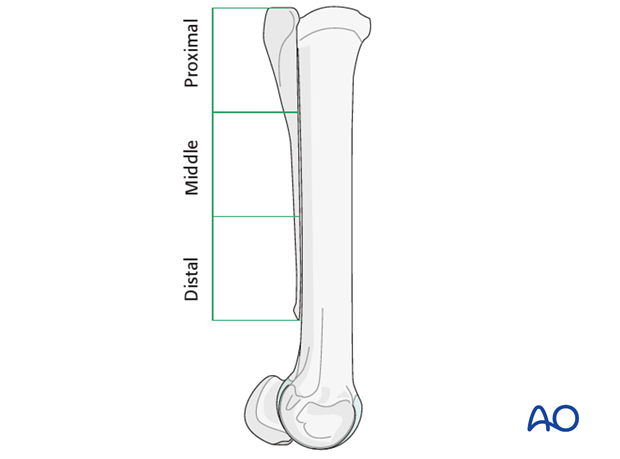 Fractures of the metacarpals/-tarsals II and IV