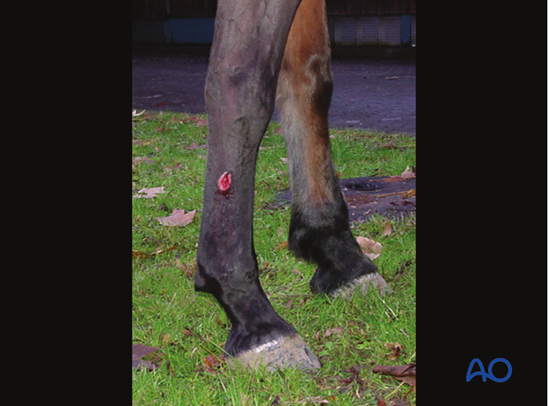 H87_D02_x20 Midbody fractures of the metacarpals/-tarsals II and IV