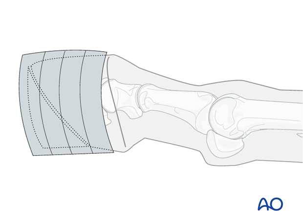 nonsurgical treatment