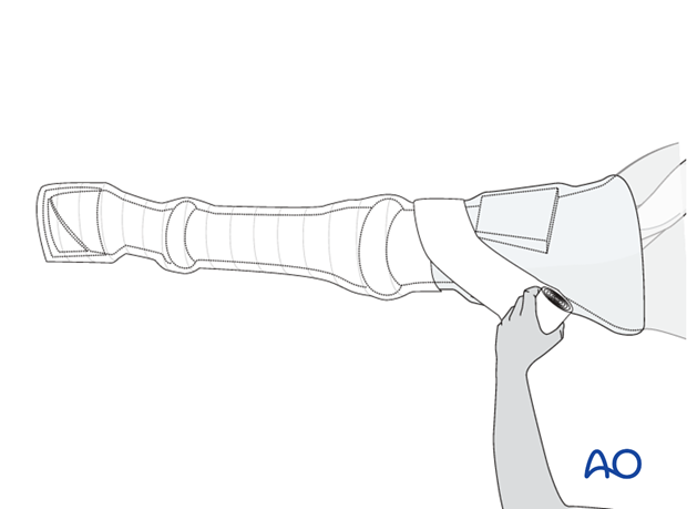 nonsurgical treatment