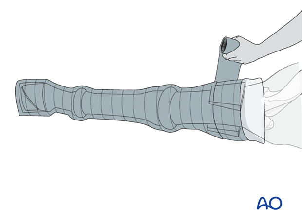 nonsurgical treatment