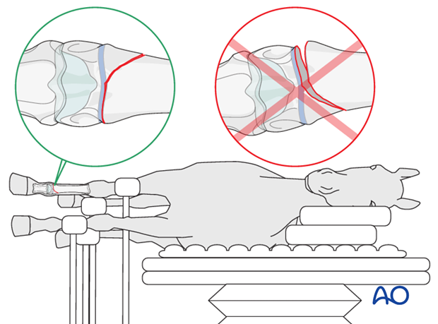 lateral recumbency Salter Harris type II