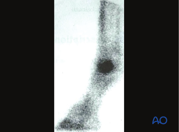 H88_Principles_Chapt71_X7C metacarpal tarsal condyles description and preoperative considerations