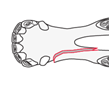 Horizontal ramus/interdental space