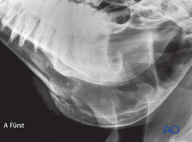 nonsurgical fracture management