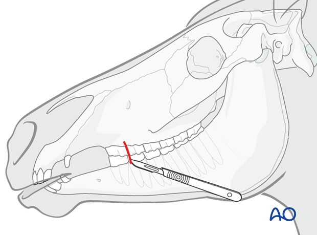 stab incision between 6 7 teeth