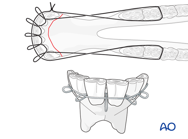 mandible rostral part bilateral