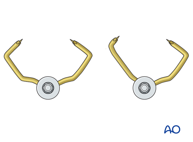 pinless external fixator