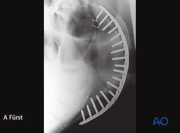 Postoperative images at 2 months