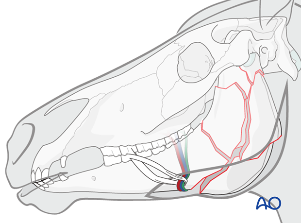 approach to vertical ramus