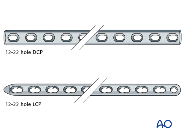 plate fixation